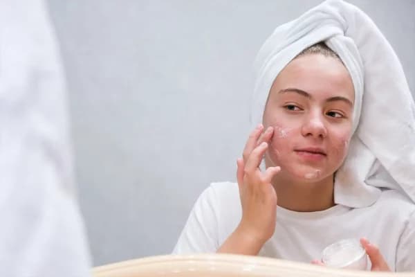 Acne Women